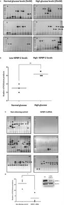 Hyperglycemia Promotes TMPRSS2-ERG Gene Fusion in Prostate Cancer Cells via Upregulating Insulin-Like Growth Factor-Binding Protein-2